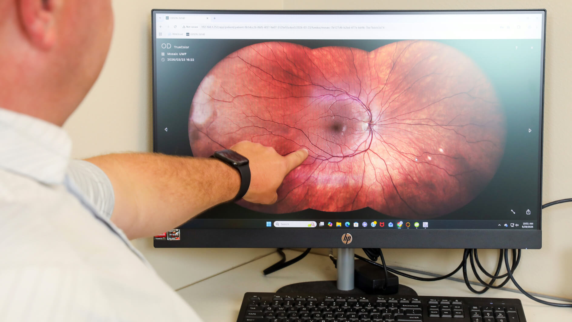 Diabetic Eye Care