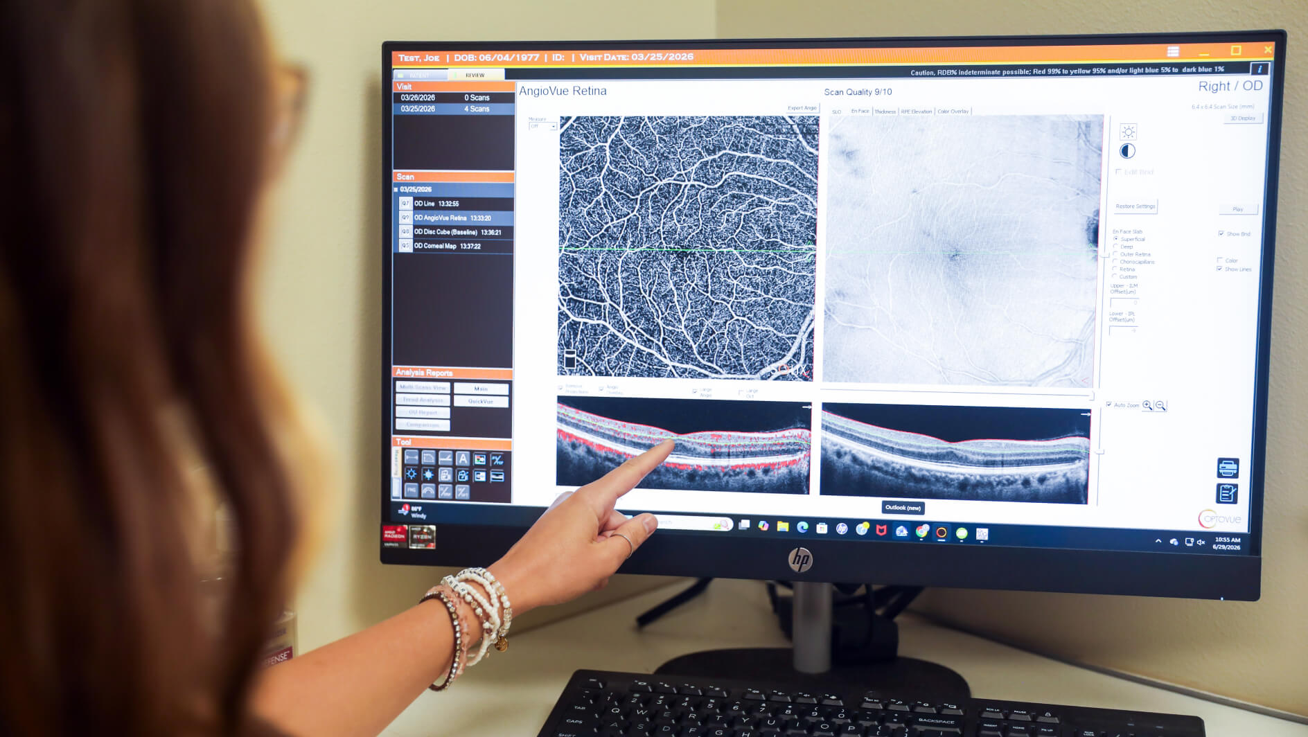 Macular Degeneration Care